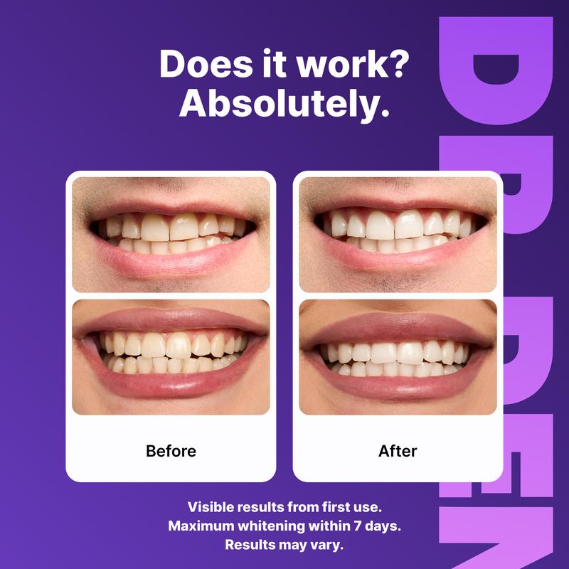 DR.DENT – Purple Whitening Strips (7 / 21 Sessions)