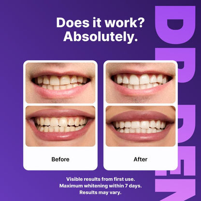 DR.DENT – Purple Whitening Strips (7 / 21 Sessions)
